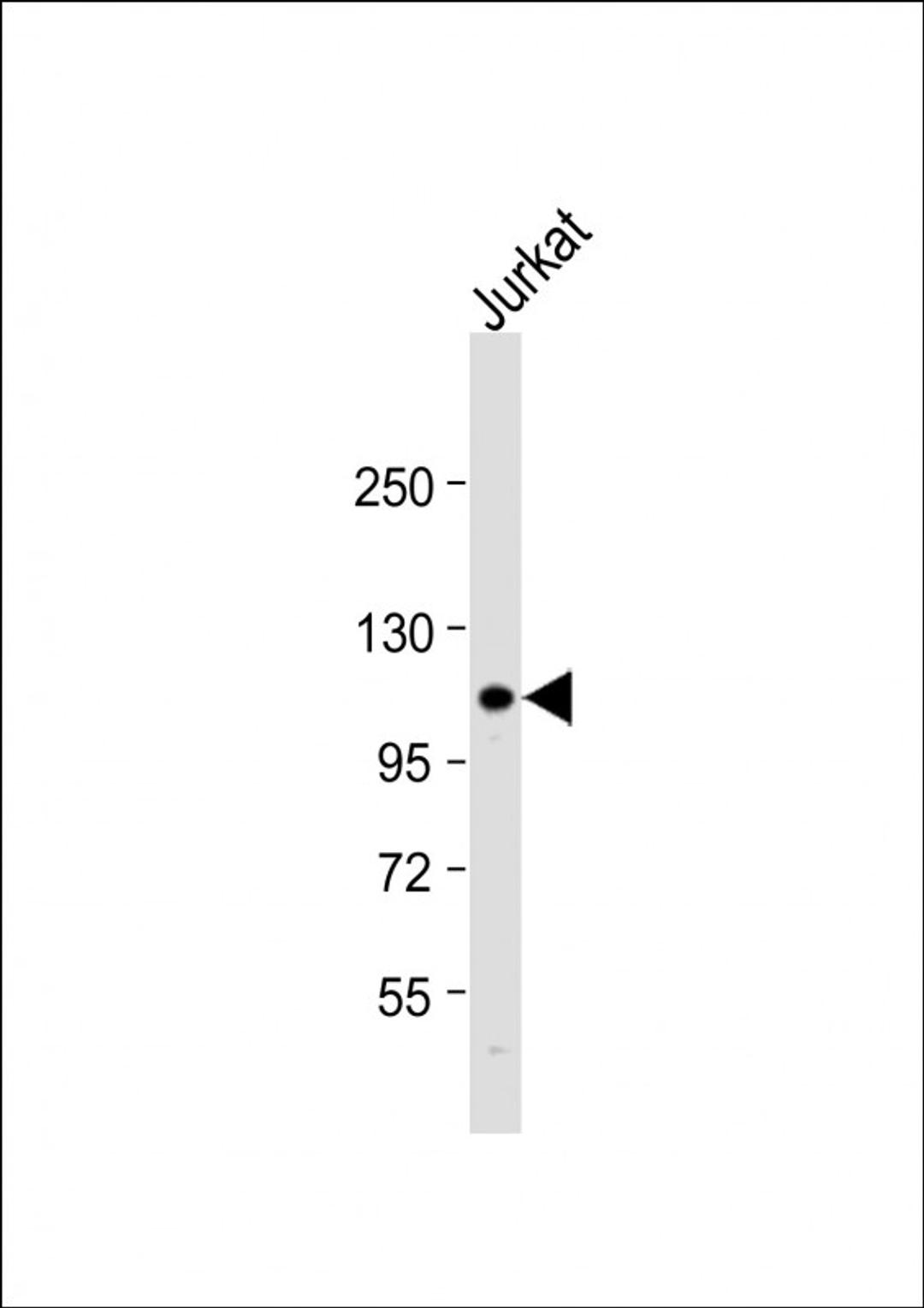 Western Blot at 1:1000 dilution + Jurkat whole cell lysate Lysates/proteins at 20 ug per lane.