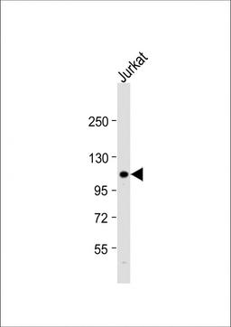 Western Blot at 1:1000 dilution + Jurkat whole cell lysate Lysates/proteins at 20 ug per lane.