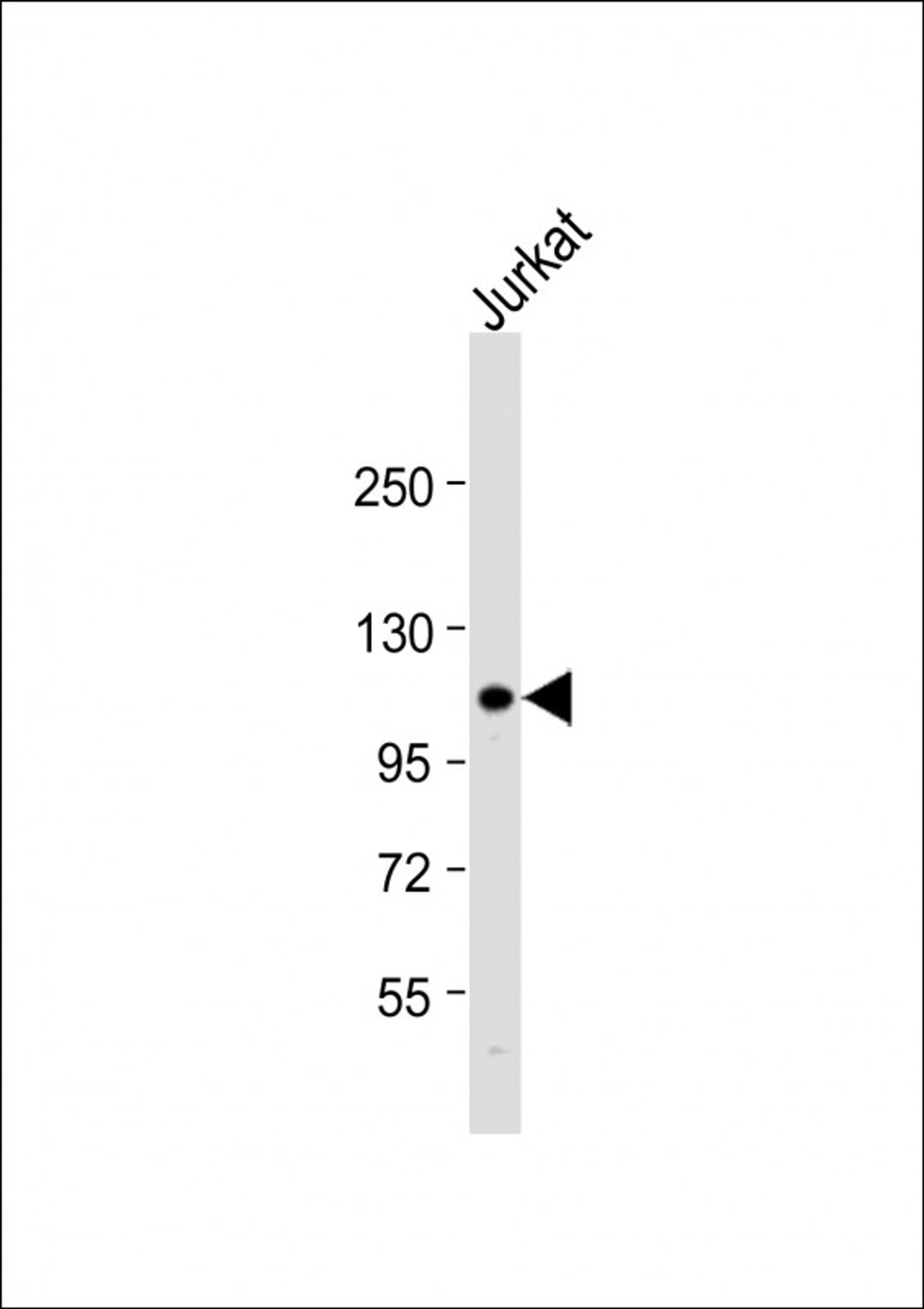 Western Blot at 1:1000 dilution + Jurkat whole cell lysate Lysates/proteins at 20 ug per lane.