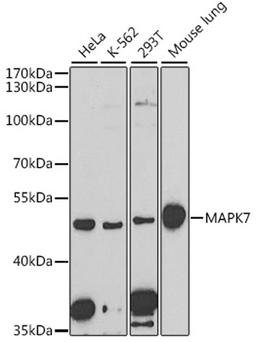 Western blot - MAPK7 antibody (A2111)