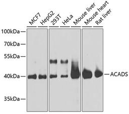 Western blot - ACADS antibody (A0945)