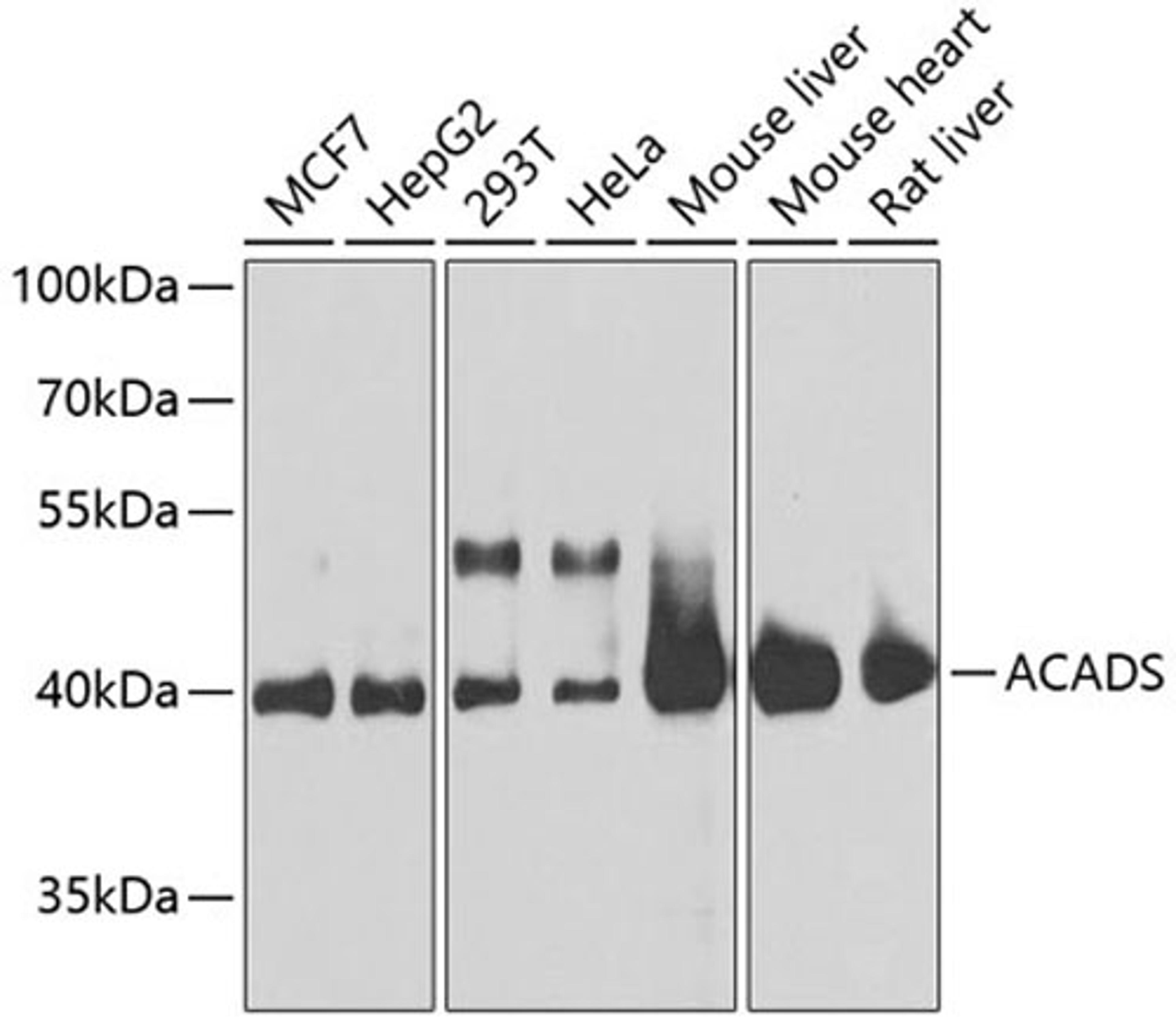 Western blot - ACADS antibody (A0945)