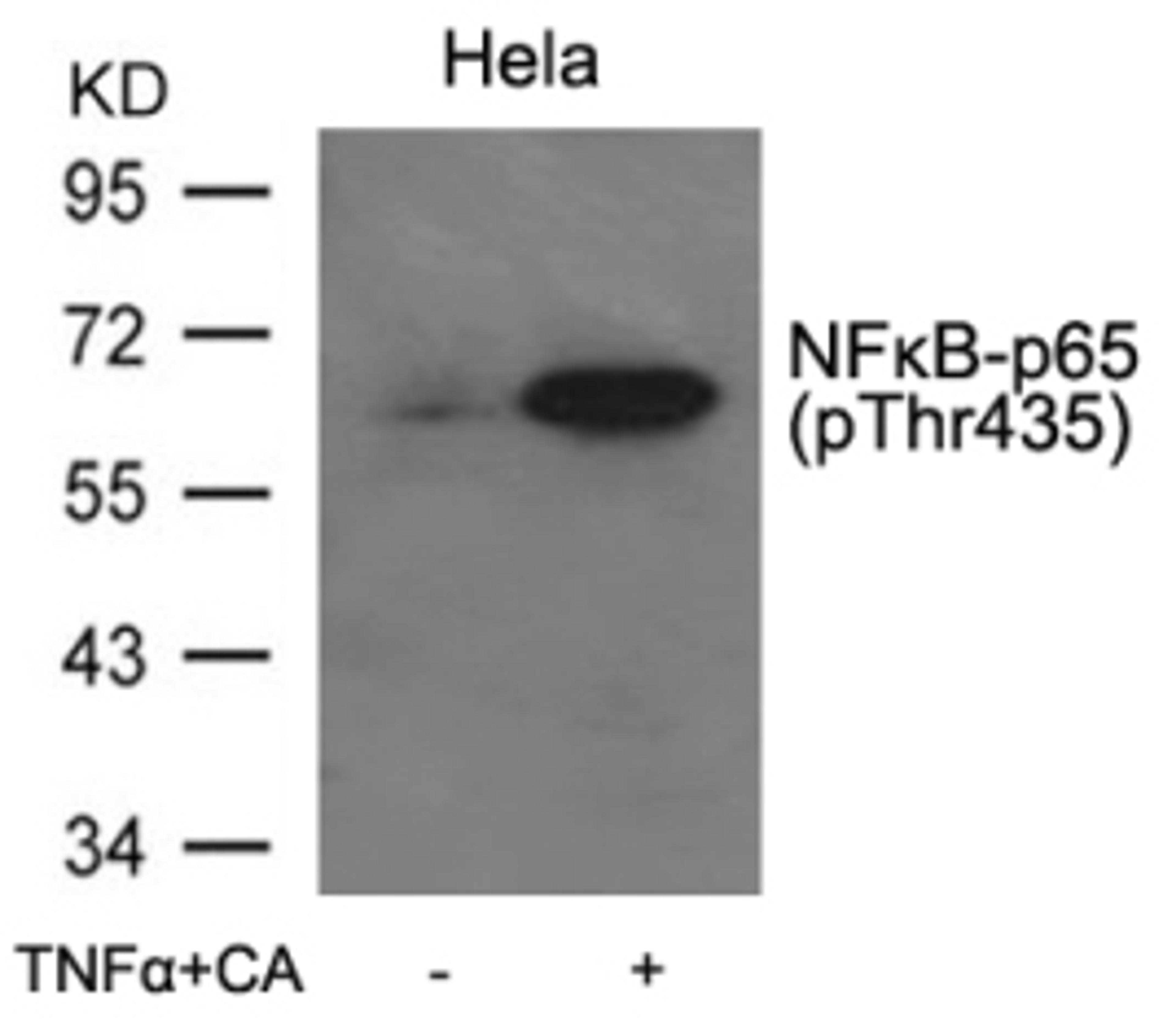 Western blot analysis of lysed extracts from HeLa cells untreated or treated with TNF&#945;+CA using NF&#954;B-p65 (Phospho-Thr435).