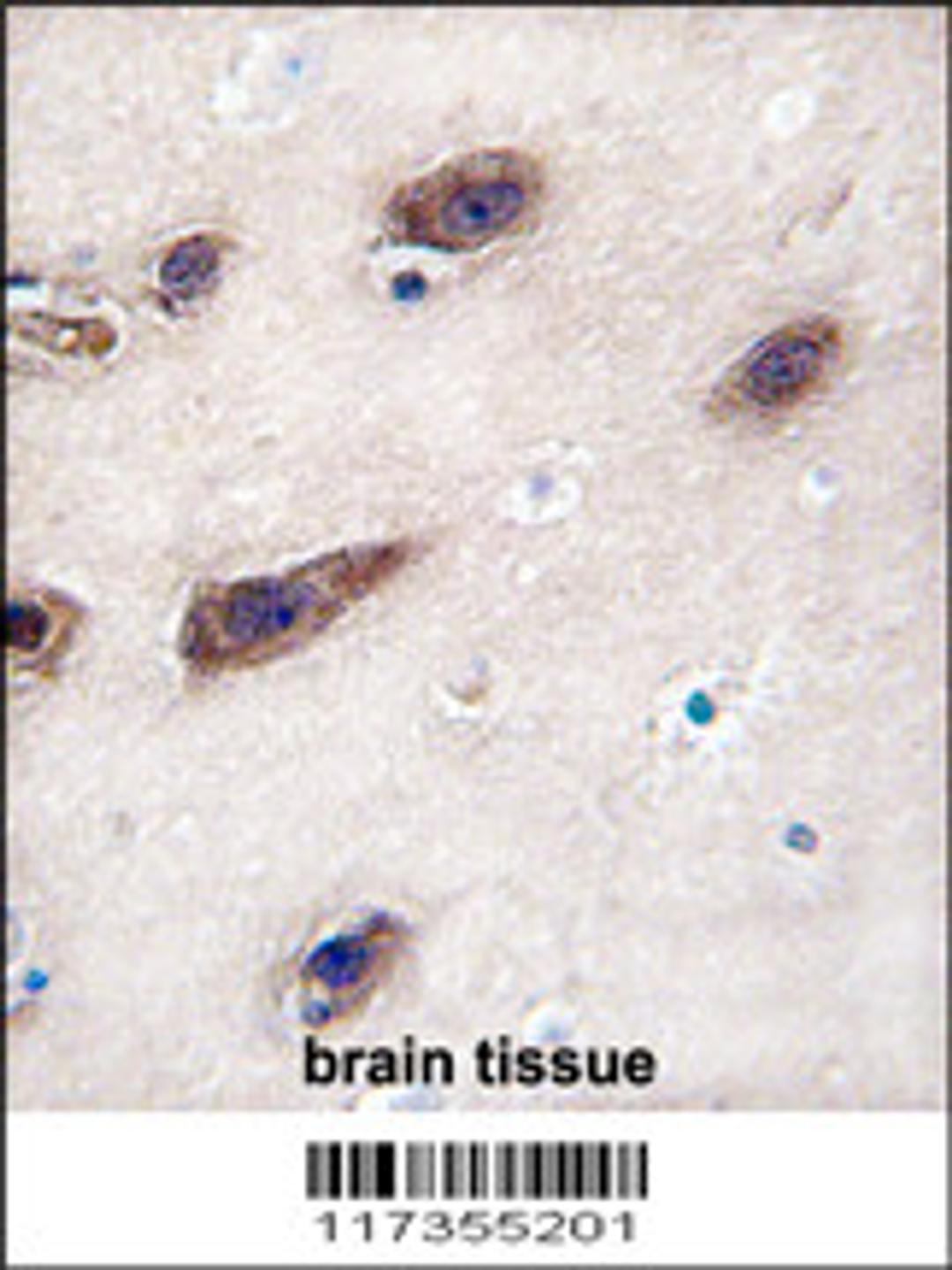 Formalin-fixed and paraffin-embedded human brain tissue reacted with STX3 antibody , which was peroxidase-conjugated to the secondary antibody, followed by DAB staining.