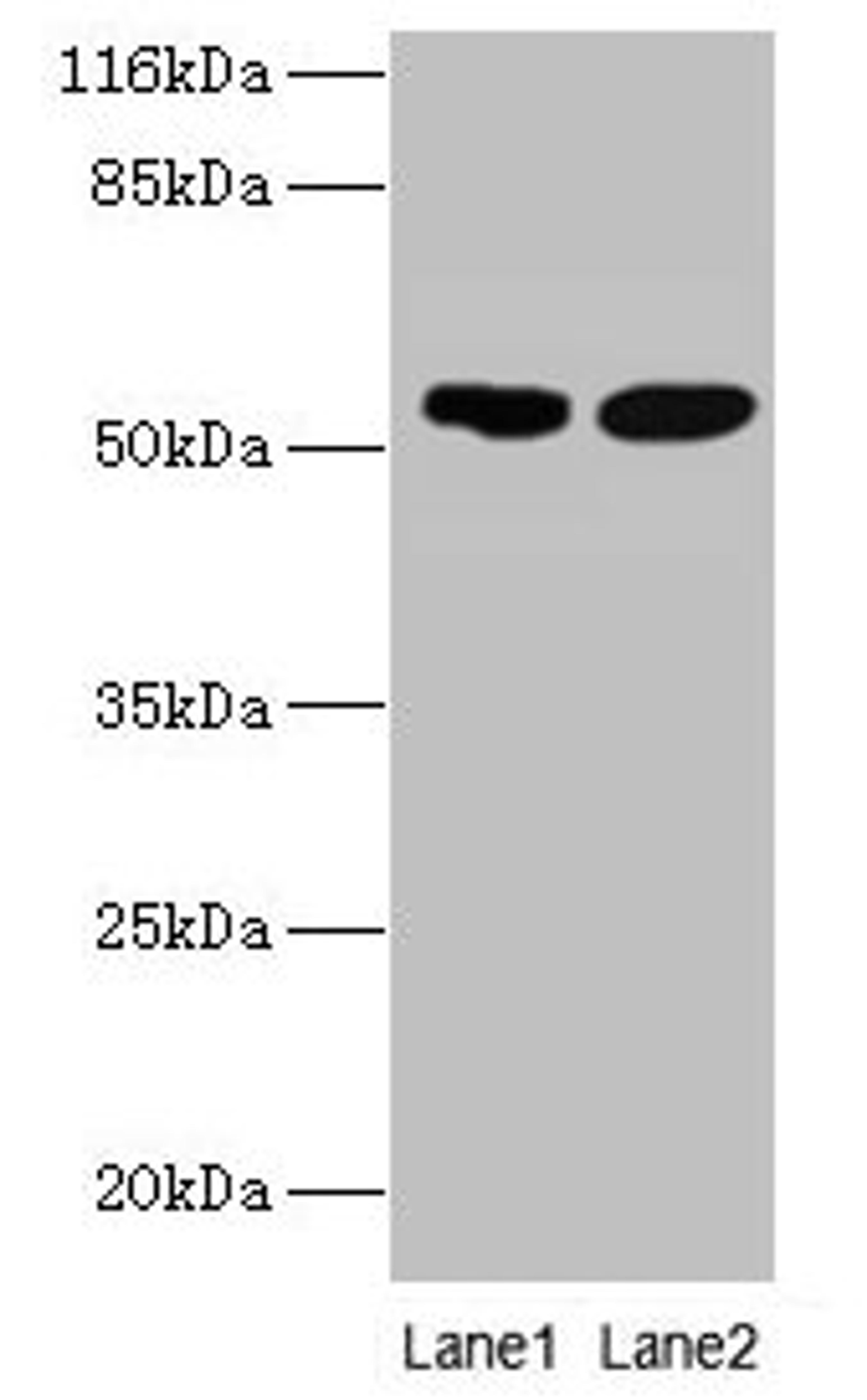 Western blot. All lanes: SVOPL antibody at 2µg/ml. Lane 1: Mouse liver tissue. Lane 2: Rat liver tissue. Secondary. Goat polyclonal to rabbit IgG at 1/10000 dilution. Predicted band size: 54, 37 kDa. Observed band size: 54 kDa