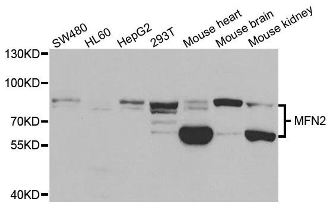 Western blot analysis of extracts of various cell lines using MFN2 antibody