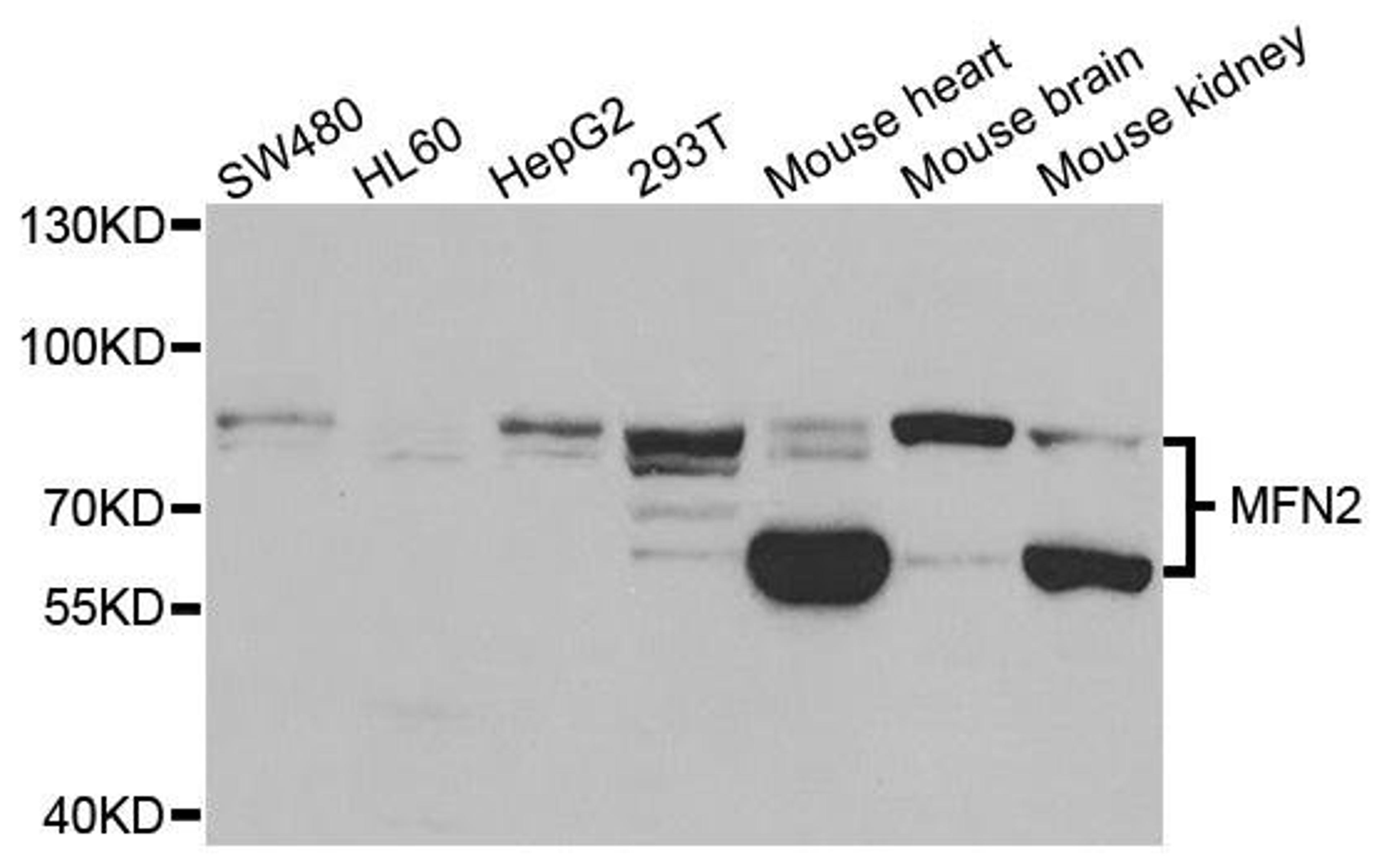 Western blot analysis of extracts of various cell lines using MFN2 antibody