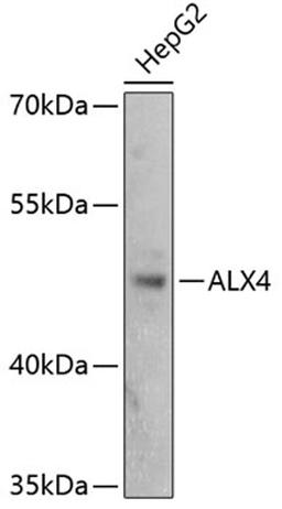 Western blot - ALX4 antibody (A2834)