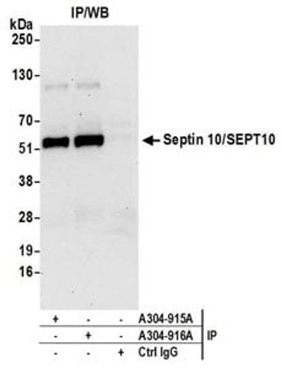 Detection of human Septin 10/SEPT10 by western blot of immunoprecipitates.