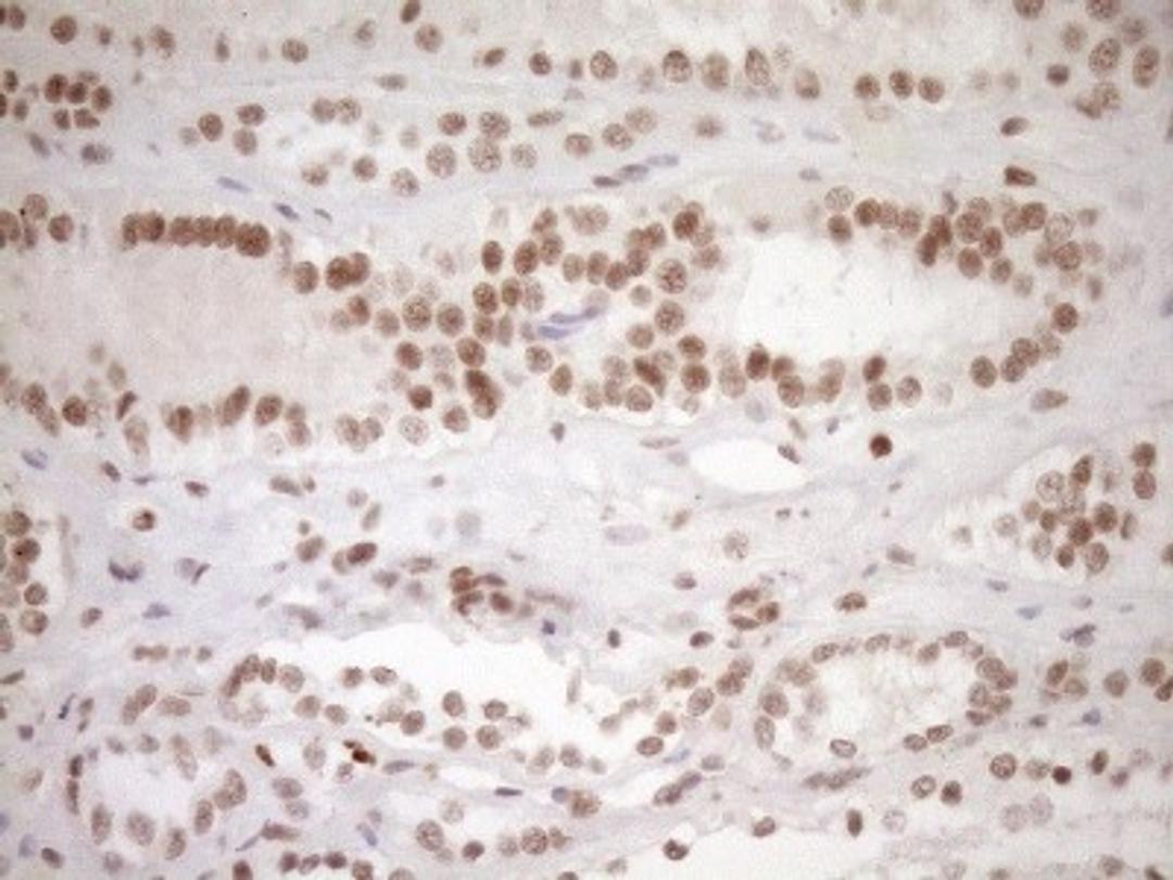 Immunohistochemistry: LXR alpha/NR1H3 Antibody (1A5) [NBP2-46220] - Analysis of Human Kidney tissue. (Heat-induced epitope retrieval by 1mM EDTA in 10mM Tris buffer (pH8.5) at 120Ã‚Â°C for 3 min)(1:150)