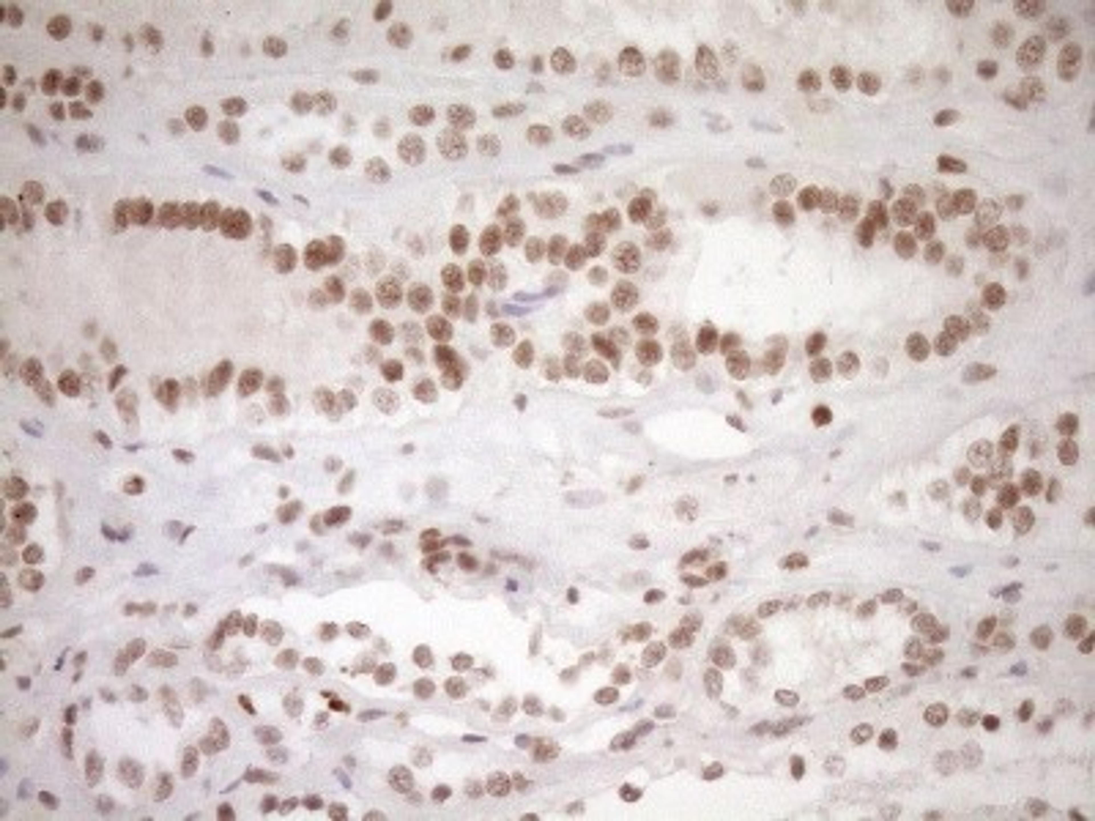 Immunohistochemistry: LXR alpha/NR1H3 Antibody (1A5) [NBP2-46220] - Analysis of Human Kidney tissue. (Heat-induced epitope retrieval by 1mM EDTA in 10mM Tris buffer (pH8.5) at 120Ã‚Â°C for 3 min)(1:150)