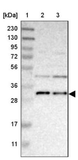 Western Blot: TMEM17 Antibody [NBP1-81974] - Lane 1: Marker [kDa] 230, 130, 95, 72, 56, 36, 28, 17, 11<br/>Lane 2: Human cell line RT-4<br/>Lane 3: Human cell line U-251MG sp