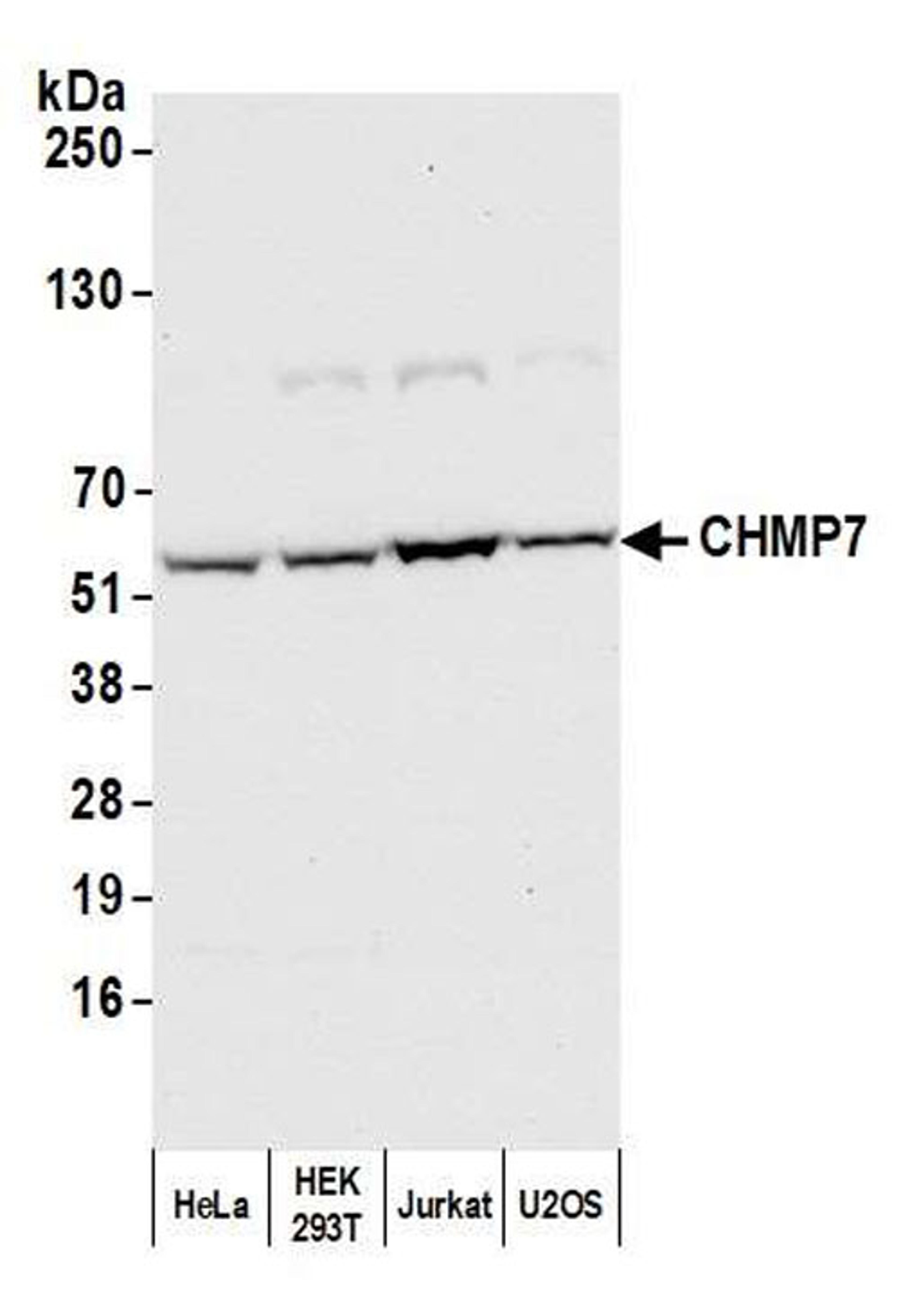 Detection of human CHMP7 by WB.