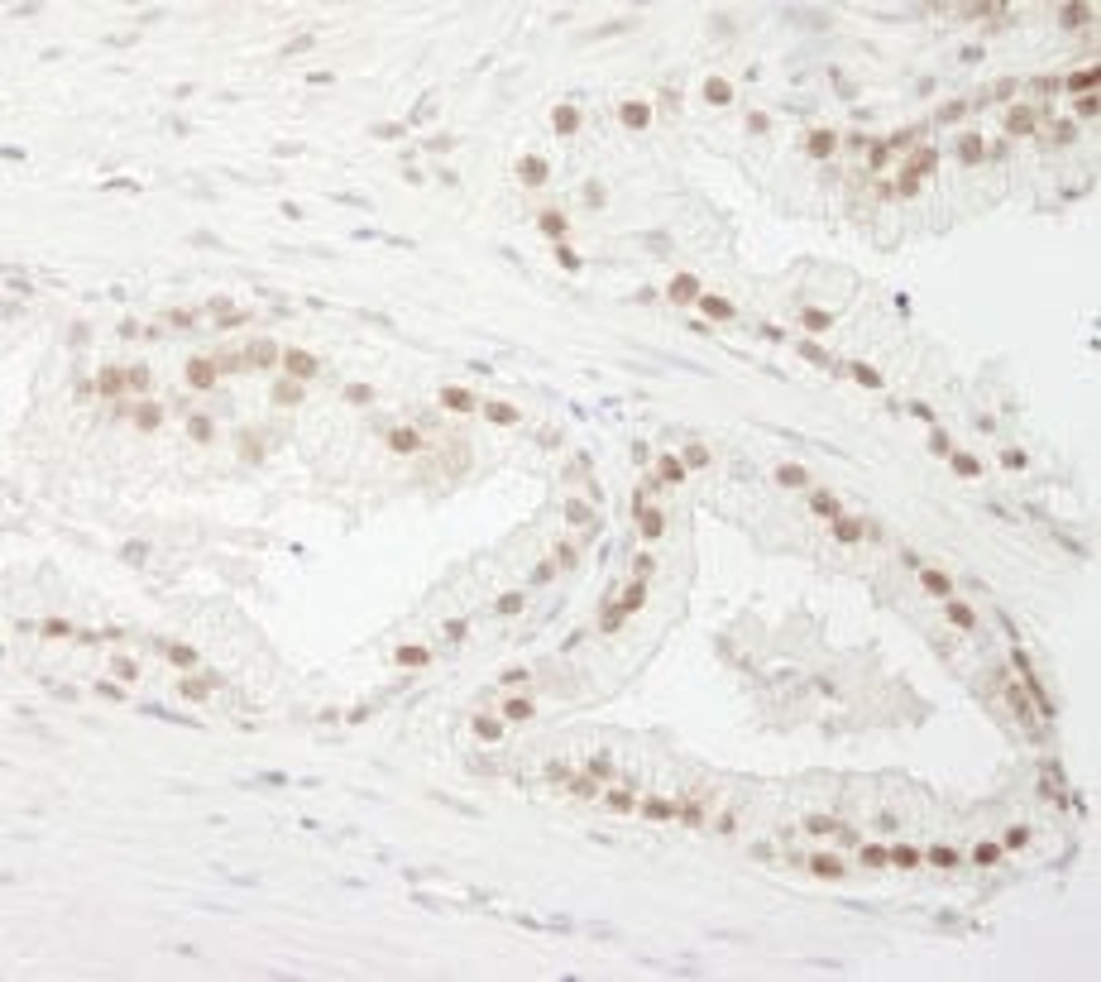 Detection of human CSTF77 by immunohistochemistry.