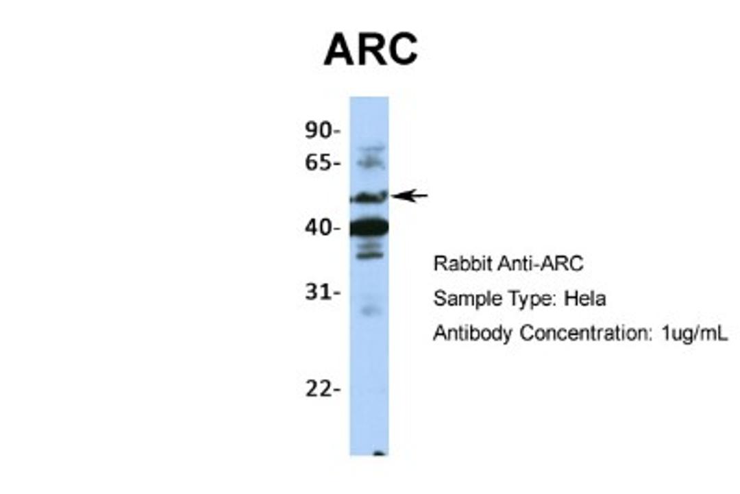 Western Blot: ARC/ARG3.1 Antibody [NBP1-56929] - Hela, Antibody Dilution: 1.0 ug/ml.