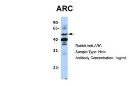 Western Blot: ARC/ARG3.1 Antibody [NBP1-56929] - Hela, Antibody Dilution: 1.0 ug/ml.