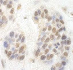 Detection of human CDK8 by immunohistochemistry.