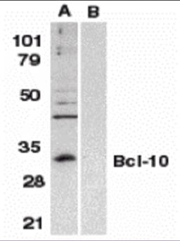 Western blot analysis of Bcl-10 in Raji whole cell lysate in the absence (A) or presence (B) of peptide (2161P) with Bcl-10 antibody at 1:500 dilution.