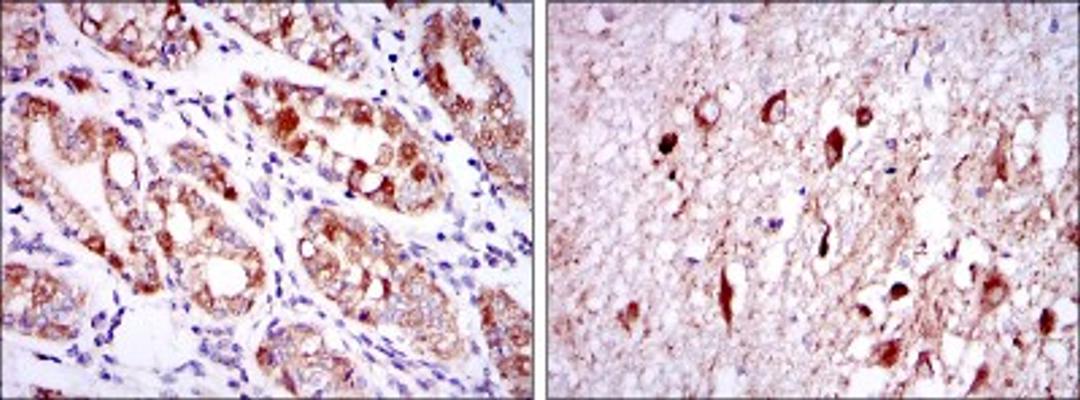 Immunohistochemistry: Otx2 Antibody (1H12G8B2) [NBP2-37596] - Immunohistochemical analysis of paraffin-embedded stomach tissues (left) and brain tissues (right) using OTX2 mouse mAb with DAB staining.