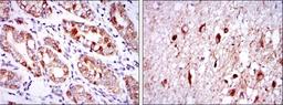 Immunohistochemistry: Otx2 Antibody (1H12G8B2) [NBP2-37596] - Immunohistochemical analysis of paraffin-embedded stomach tissues (left) and brain tissues (right) using OTX2 mouse mAb with DAB staining.