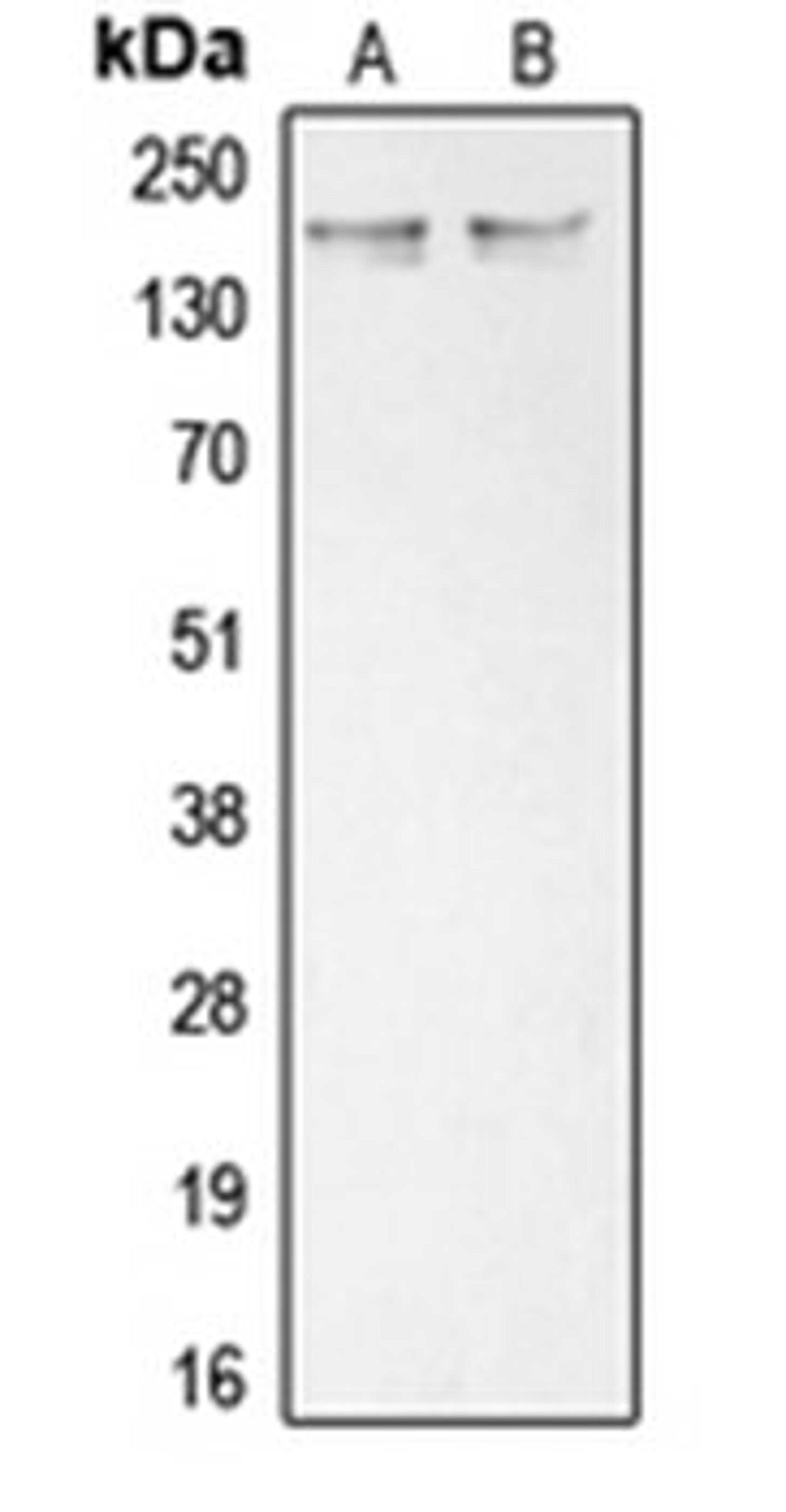 Western blot analysis of K562 (Lane 1), Saos2 (Lane 2) whole cell lysates using COL11A1 antibody