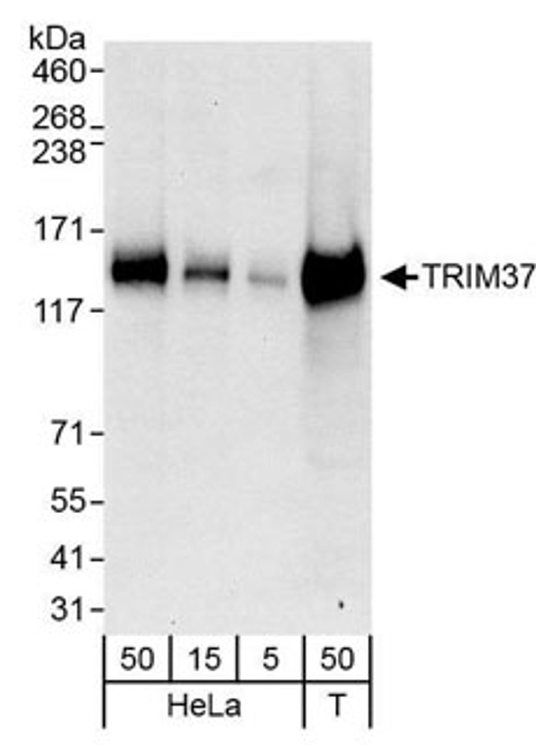 Detection of human TRIM37 by western blot.