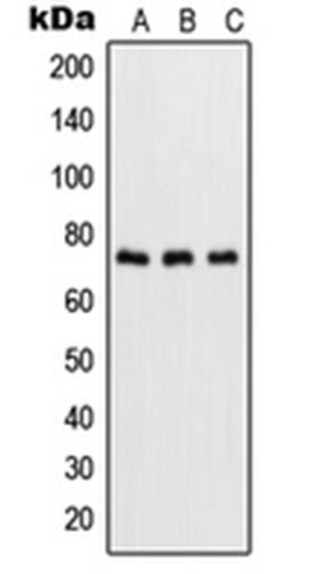 Western blot analysis of HeLa TNFa-treated (Lane 1), NIH3T3 LPS-treated (Lane 2), rat brain (Lane 3) whole cell lysates using RELA antibody