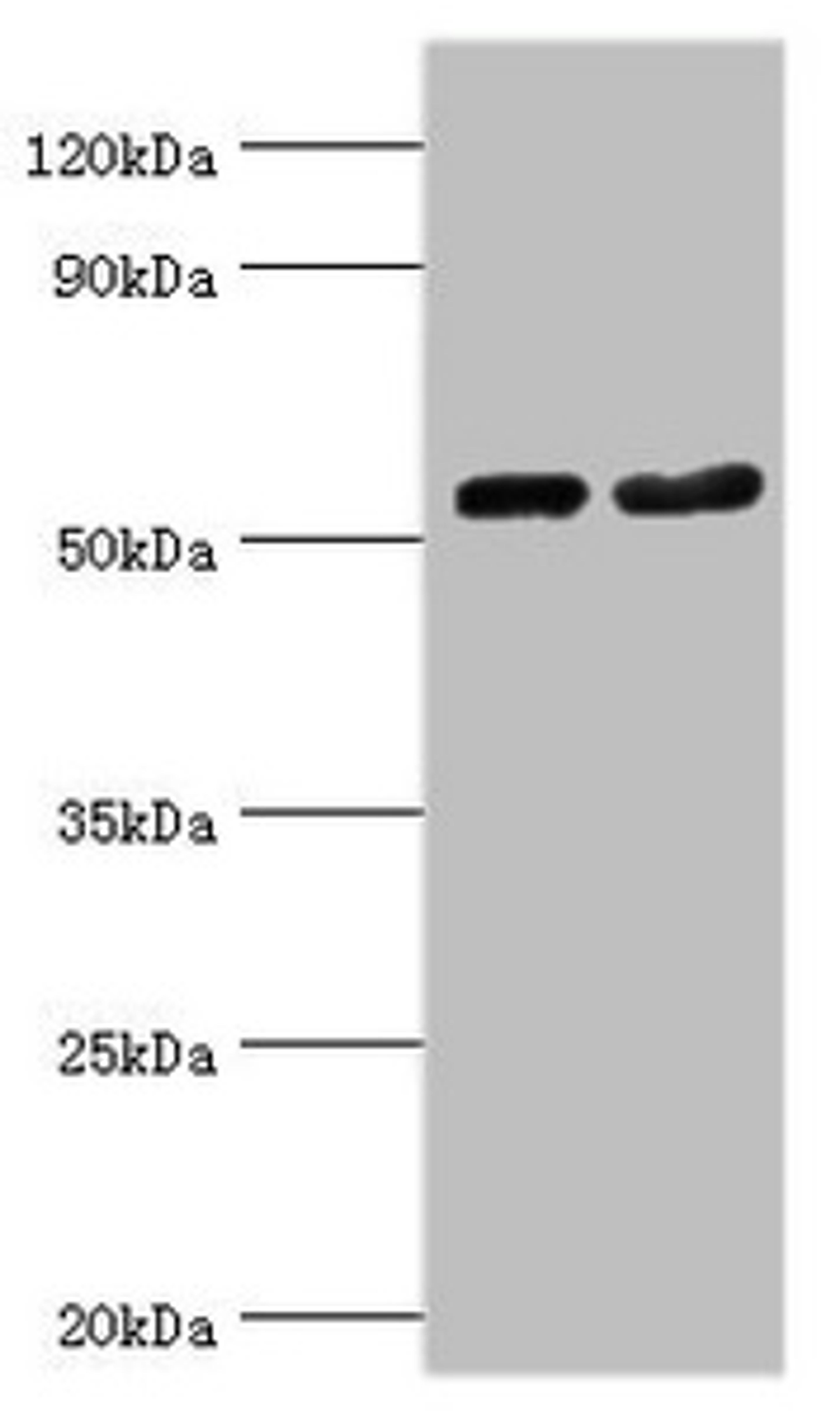 Western blot. All lanes: Septin-7 antibody at 9ug/ml. Lane 1: Hela whole cell lysate. Lane 2: Mouse gonad tissue. Secondary. Goat polyclonal to rabbit IgG at 1/10000 dilution. Predicted band size: 51 kDa. Observed band size: 51 kDa.