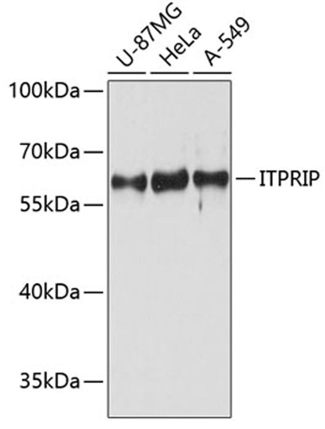 Western blot - ITPRIP antibody (A11725)