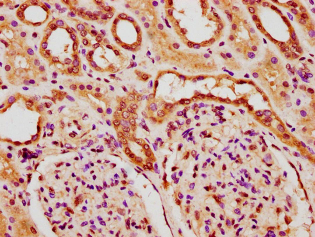 IHC image of CSB-PA010378PA84nforHU diluted at 1:20 and staining in paraffin-embedded human kidney tissue performed on a Leica BondTM system. After dewaxing and hydration, antigen retrieval was mediated by high pressure in a citrate buffer (pH 6.0). Section was blocked with 10% normal goat serum 30min at RT. Then primary antibody (1% BSA) was incubated at 4°C overnight. The primary is detected by a biotinylated secondary antibody and visualized using an HRP conjugated SP system.