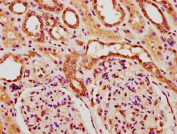 IHC image of CSB-PA010378PA84nforHU diluted at 1:20 and staining in paraffin-embedded human kidney tissue performed on a Leica BondTM system. After dewaxing and hydration, antigen retrieval was mediated by high pressure in a citrate buffer (pH 6.0). Section was blocked with 10% normal goat serum 30min at RT. Then primary antibody (1% BSA) was incubated at 4°C overnight. The primary is detected by a biotinylated secondary antibody and visualized using an HRP conjugated SP system.