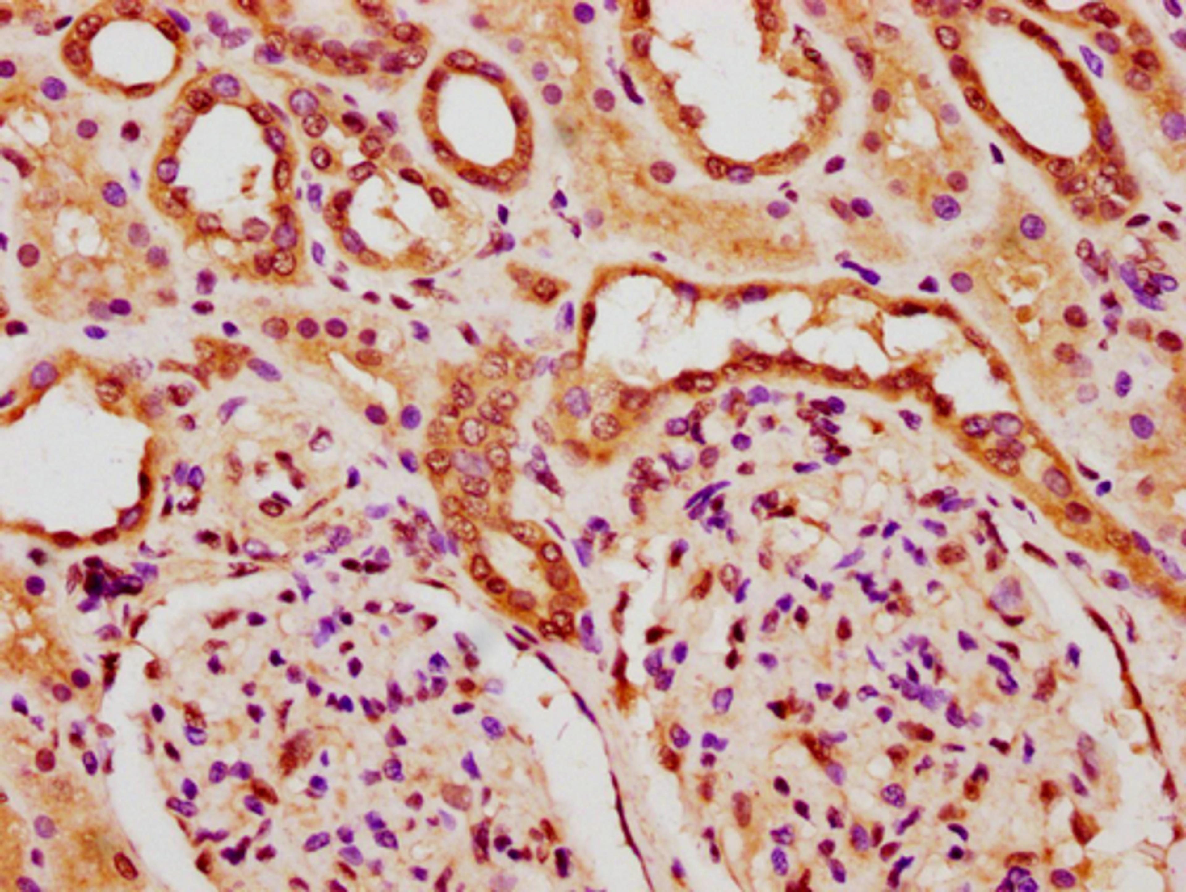 IHC image of CSB-PA010378PA84nforHU diluted at 1:20 and staining in paraffin-embedded human kidney tissue performed on a Leica BondTM system. After dewaxing and hydration, antigen retrieval was mediated by high pressure in a citrate buffer (pH 6.0). Section was blocked with 10% normal goat serum 30min at RT. Then primary antibody (1% BSA) was incubated at 4°C overnight. The primary is detected by a biotinylated secondary antibody and visualized using an HRP conjugated SP system.