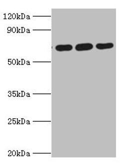 Western blot. All lanes: ATAD3A antibody at 4ug/ml. Lane 1: A549 whole cell lysate. Lane 2: Mouse spleen tissue. Lane 3: Mouse liver tissue. Secondary. Goat polyclonal to rabbit IgG at 1/10000 dilution. Predicted band size: 72, 67, 58 kDa. Observed band size: 72 kDa.