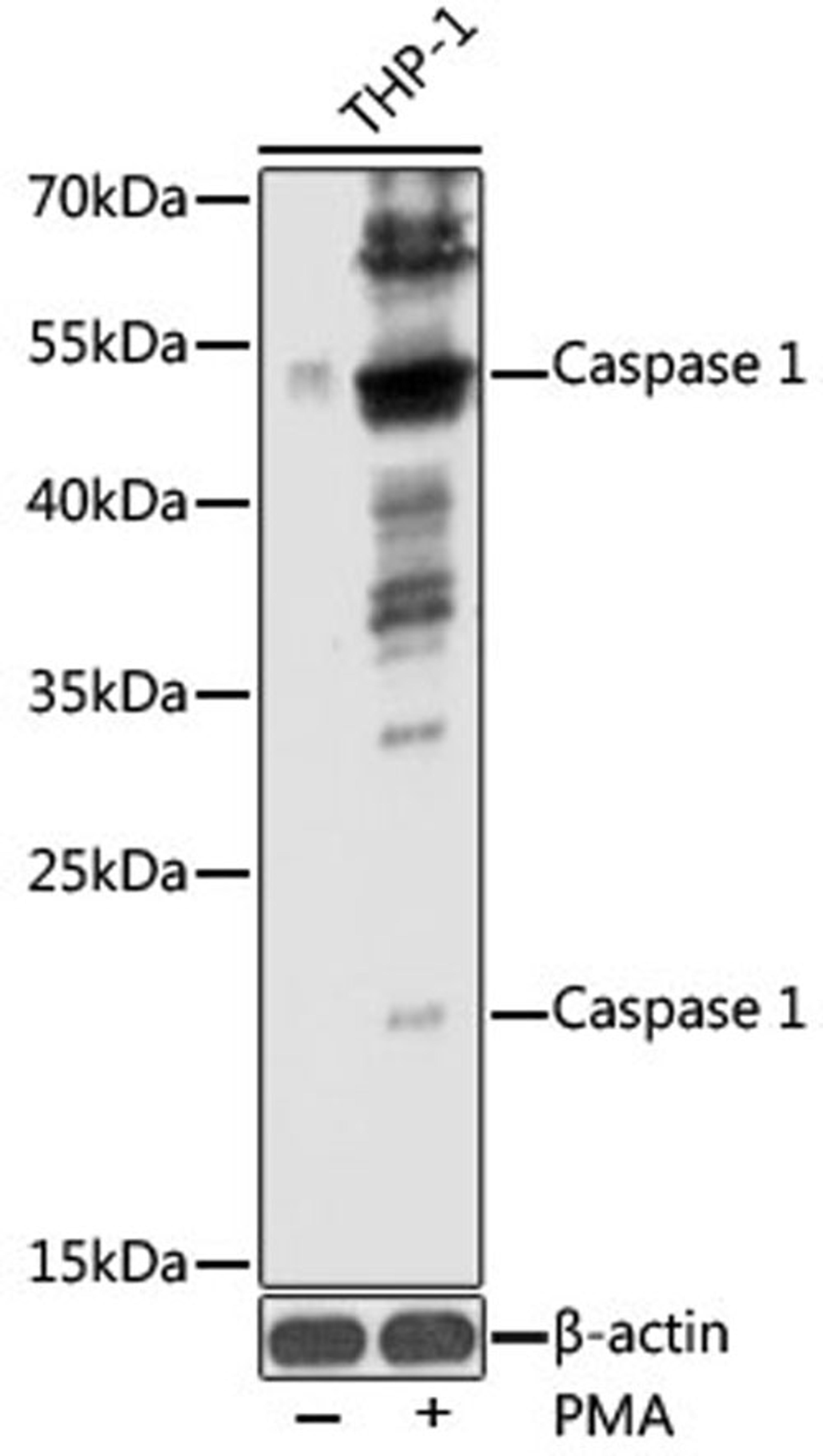 Western blot - Caspase-1 antibody (A16792)