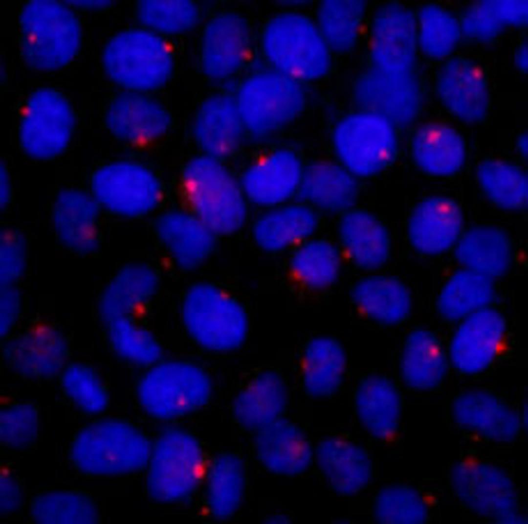 Detection of human CEP131/AZ1 by immunocytochemistry.