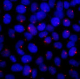 Detection of human CEP131/AZ1 by immunocytochemistry.