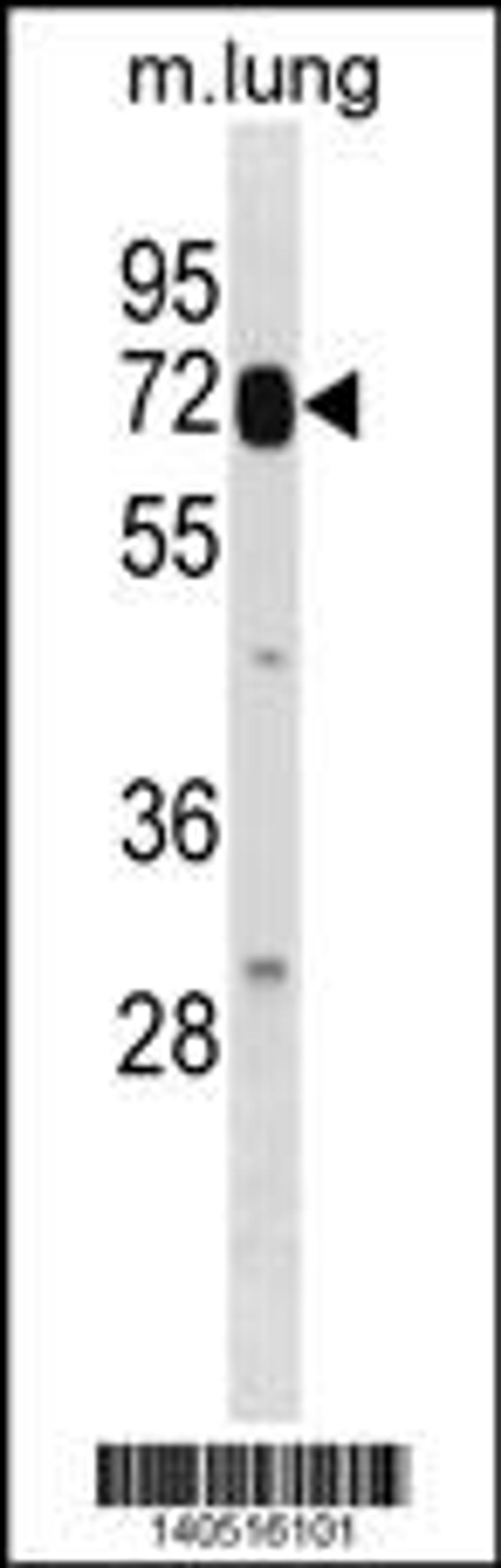 Western blot analysis in mouse lung tissue lysates (35ug/lane).