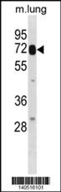 Western blot analysis in mouse lung tissue lysates (35ug/lane).