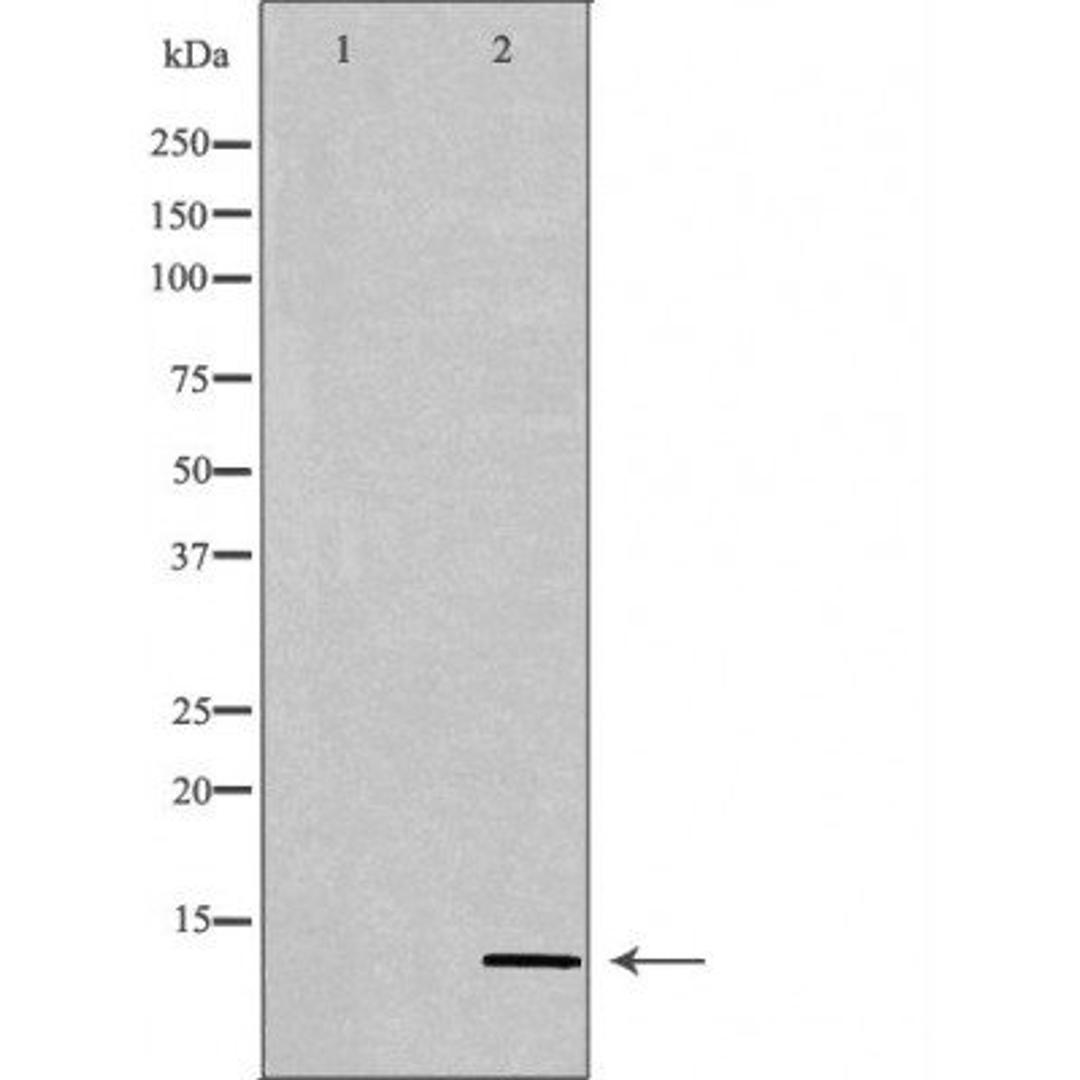 Western blot analysis of HeLa cell lines using PATE3 antibody