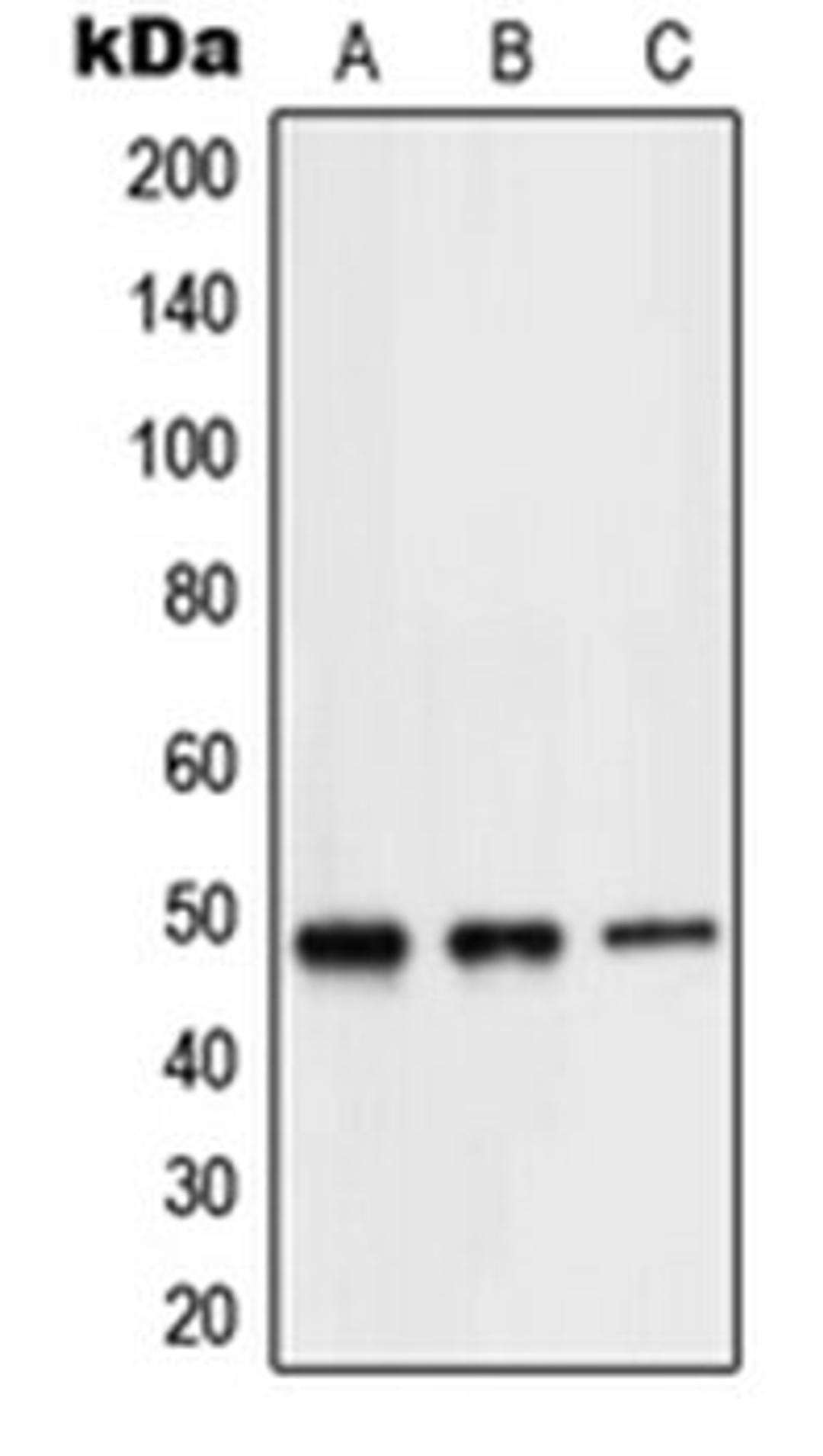 Western blot analysis of Jurkat (Lane 1), mouse brain (Lane 2), rat brain (Lane 3) whole cell lysates using NEUROD2 antibody