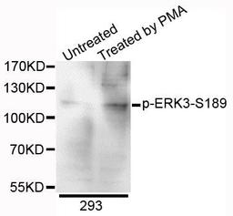 Western blot analysis of extracts of 293 cells using ERK3 (phospho-Ser189) antibody