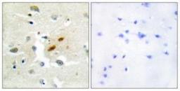 Immunohistochemistry-Paraffin: REV3L Antibody [NBP1-67789] - Analysis of paraffin-embedded human brain tissue, using . The picture on the right is treated with the synthesized peptide.