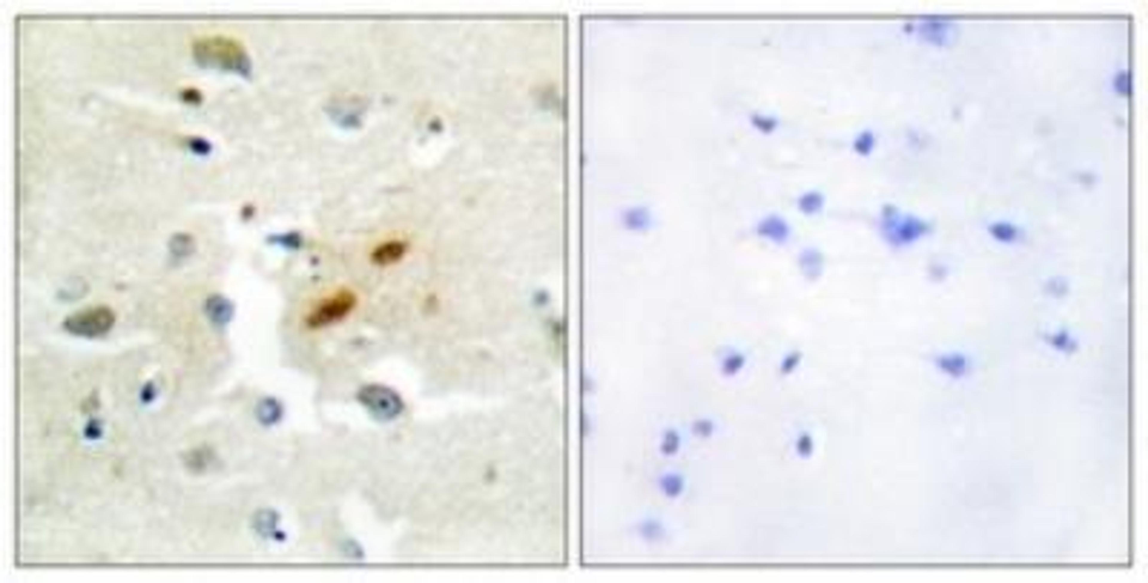 Immunohistochemistry-Paraffin: REV3L Antibody [NBP1-67789] - Analysis of paraffin-embedded human brain tissue, using . The picture on the right is treated with the synthesized peptide.