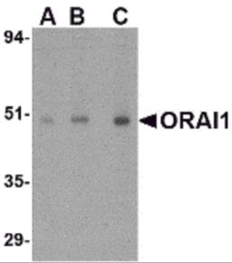 Western blot analysis of ORAI1 in human ovary tissue lysate with ORAI1 antibody at (A) 0.5, (B) 1 and (C) 2 &#956;g/mL.