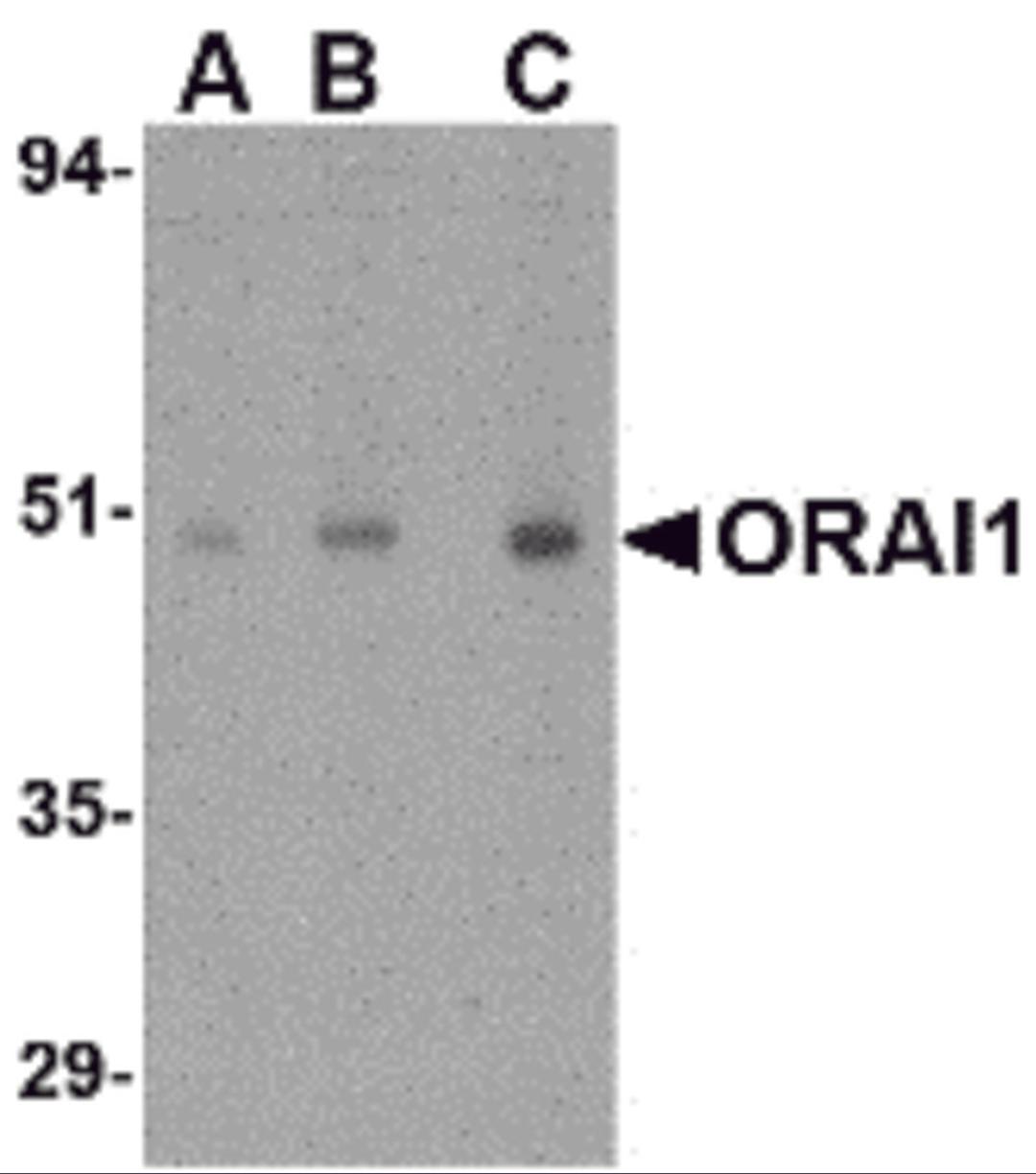 Western blot analysis of ORAI1 in human ovary tissue lysate with ORAI1 antibody at (A) 0.5, (B) 1 and (C) 2 μg/mL.