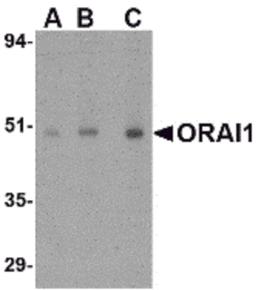 Western blot analysis of ORAI1 in human ovary tissue lysate with ORAI1 antibody at (A) 0.5, (B) 1 and (C) 2 μg/mL.