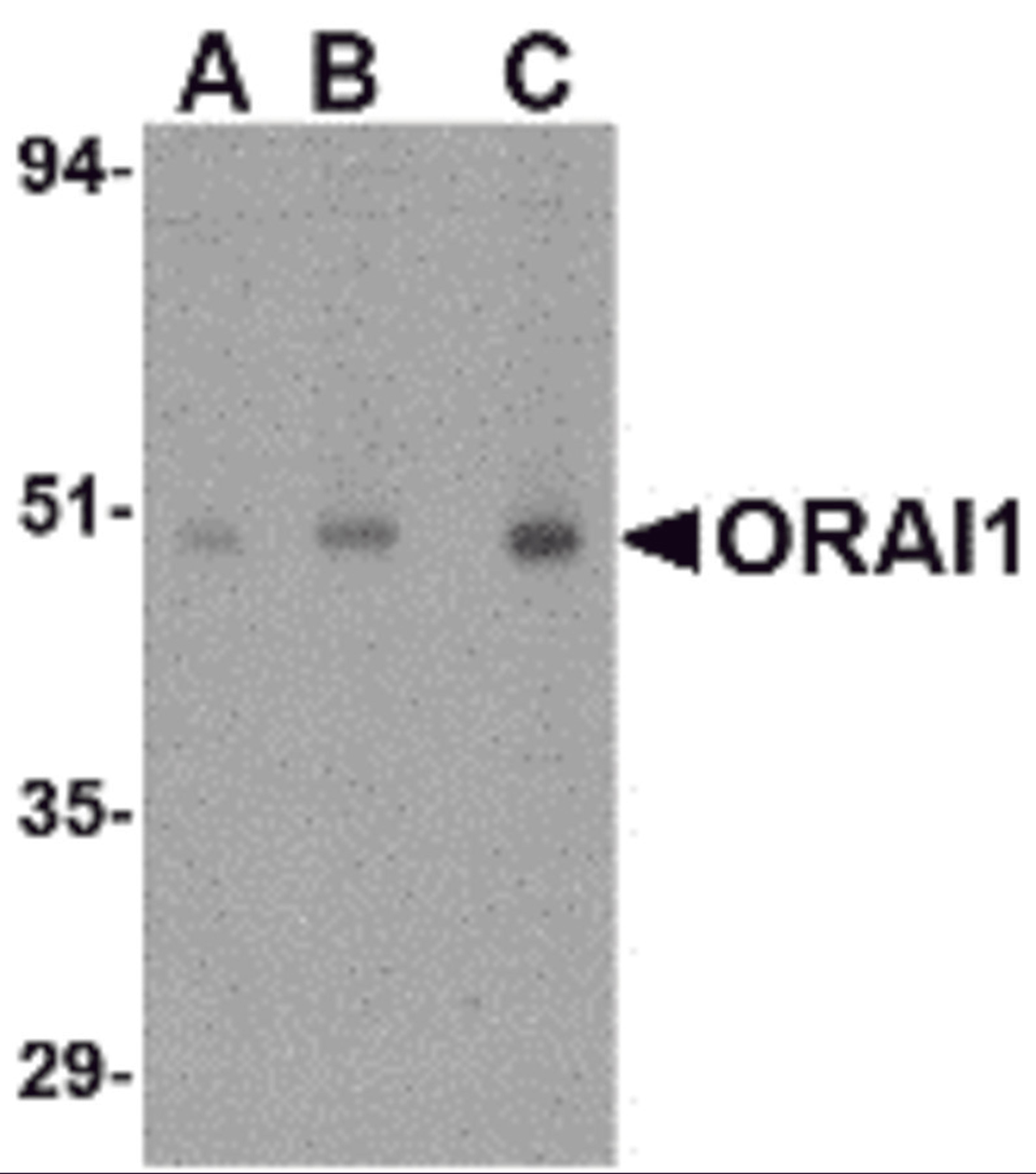 Western blot analysis of ORAI1 in human ovary tissue lysate with ORAI1 antibody at (A) 0.5, (B) 1 and (C) 2 μg/mL.