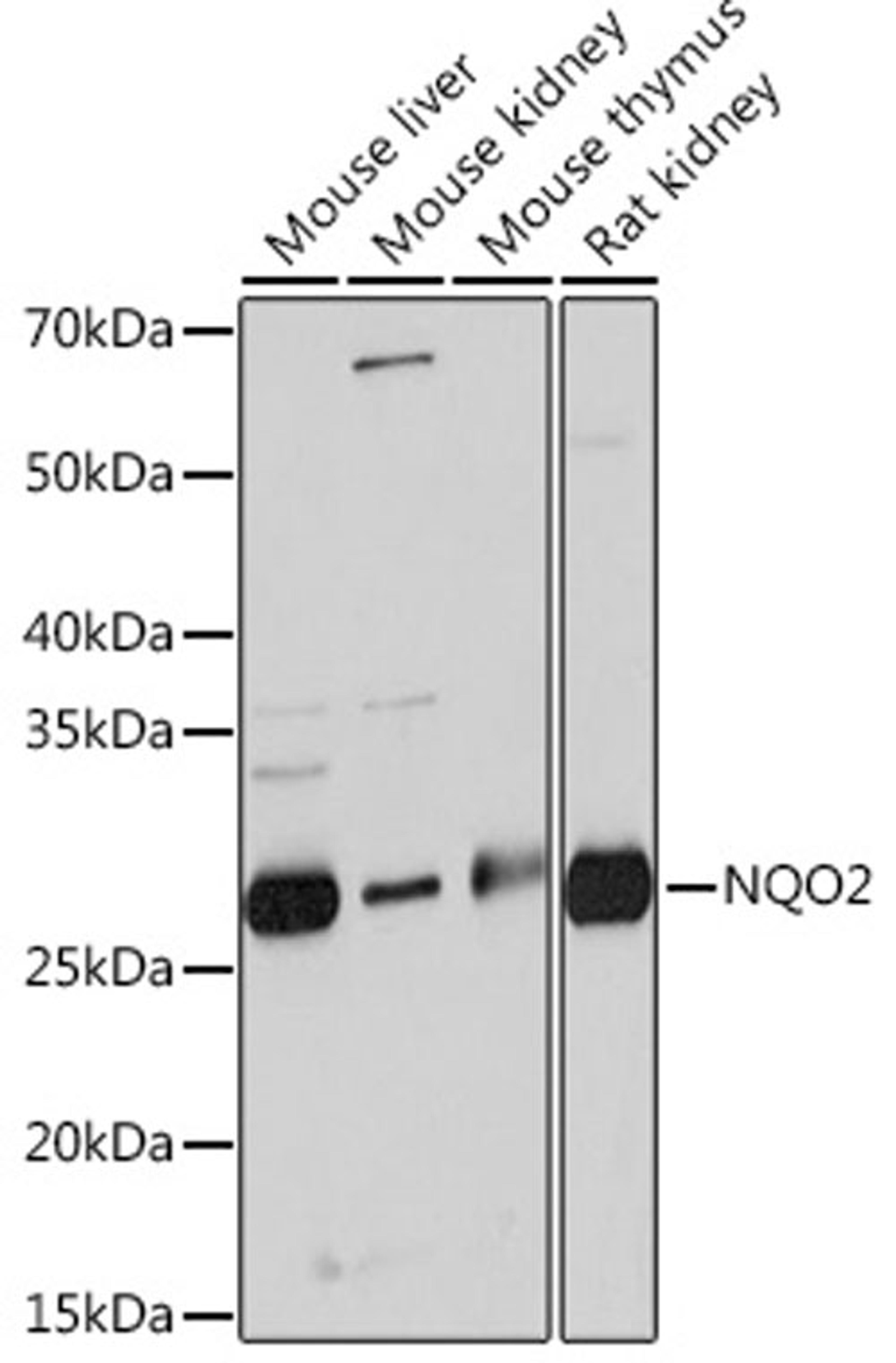 Western blot - NQO2 Rabbit mAb (A3846)