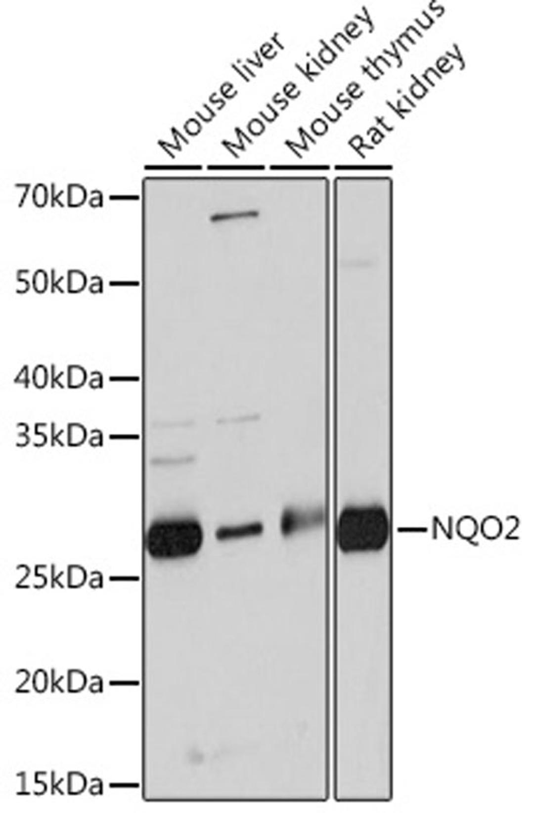 Western blot - NQO2 Rabbit mAb (A3846)