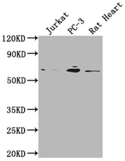 Western Blot. Positive WB detected in: Jurkat whole cell lysate, PC-3 whole cell lysate, Rat Heart tissue. All lanes: E2F1 antibody at 1:2000. Secondary. Goat polyclonal to rabbit IgG at 1/50000 dilution. Predicted band size: 47 kDa. Observed band size: 60 kDa. 